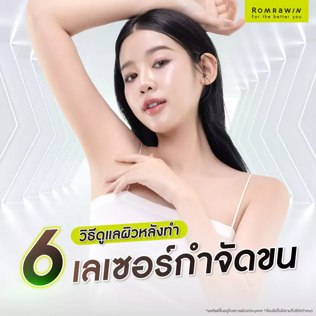 การดูแลผิวหลังทำเลเซอร์กำจัดขน