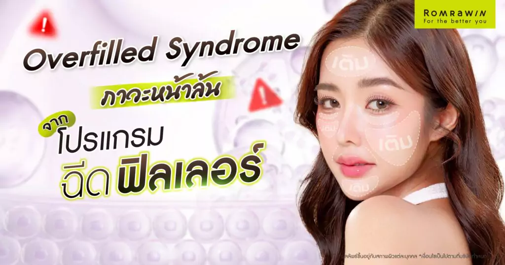 Overfilled Syndrome