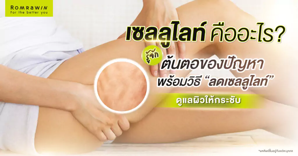 เซลลูไลท์ คืออะไร