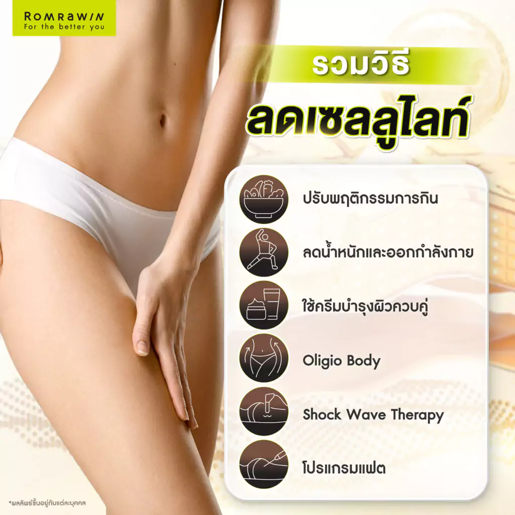 วิธีลดเซลลูไลท์ด้วยตัวเอง ทำอย่างไร?