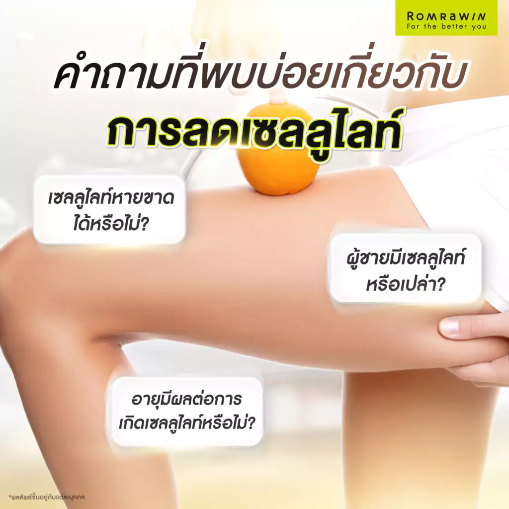 คำถามที่พบบ่อยเกี่ยวกับการลดเซลลูไลท์