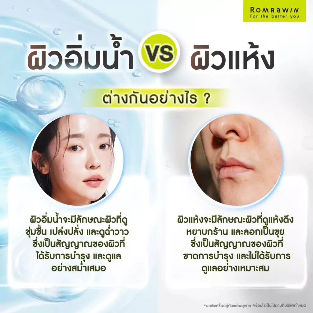 ผิวอิ่มน้ำ กับ ผิวแห้ง ต่างกันอย่างไร?