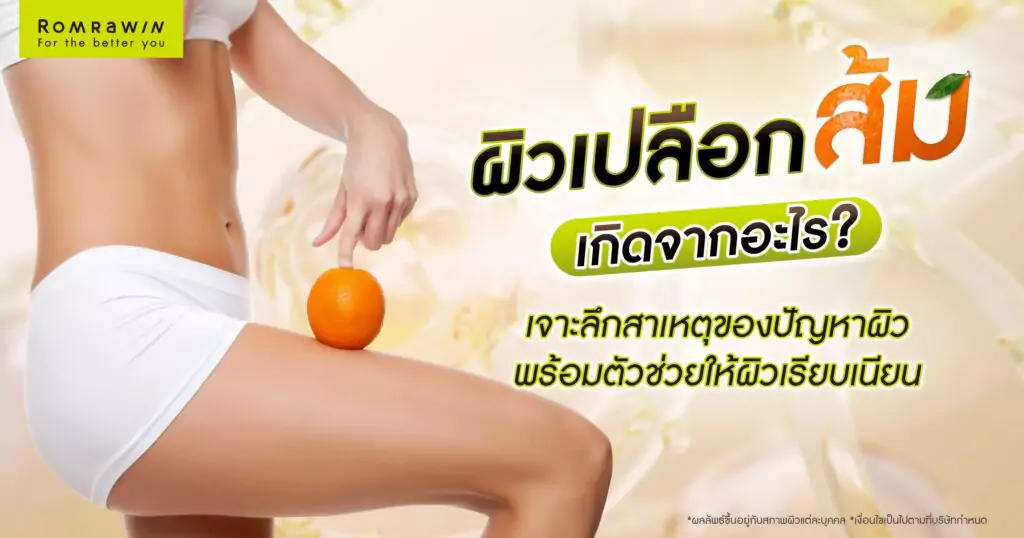 ผิวเปลือกส้ม