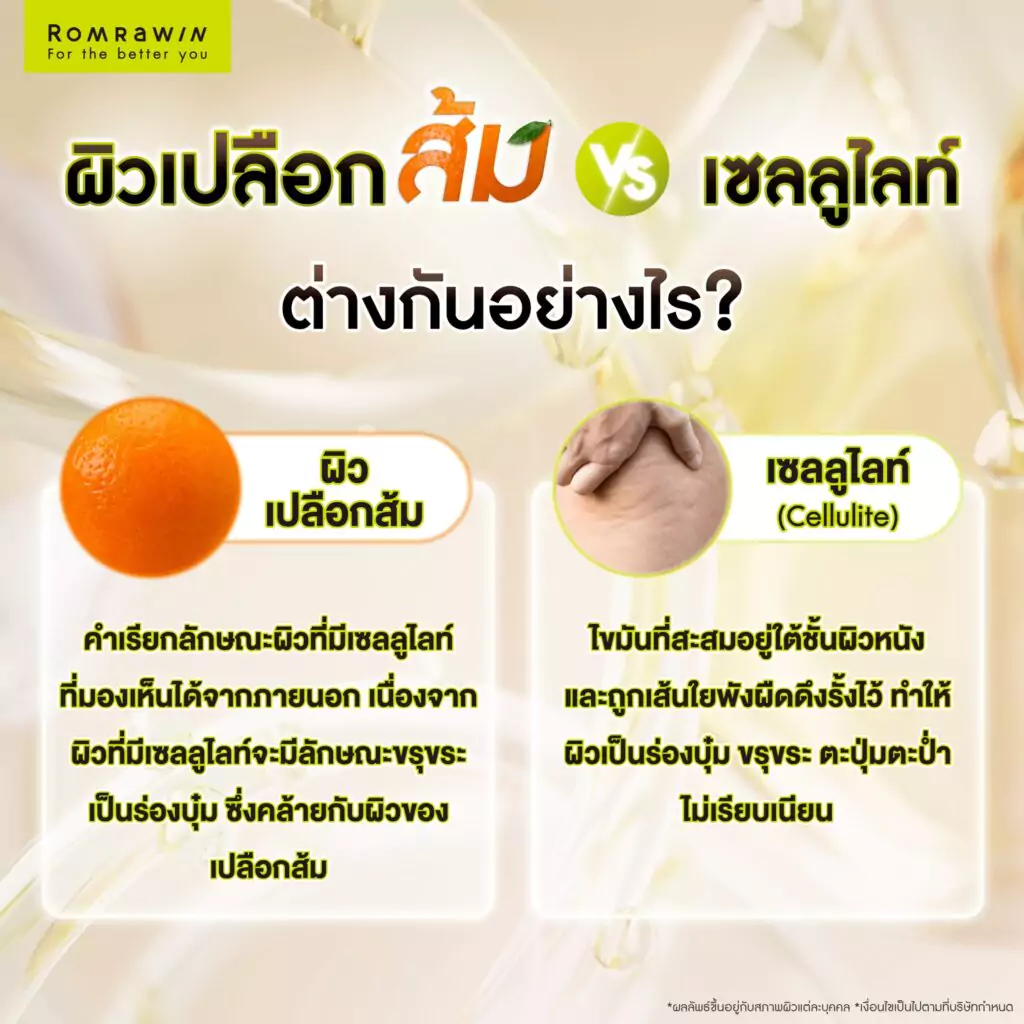 ผิวเปลือกส้ม VS เซลลูไลท์ ต่างกันอย่างไร?