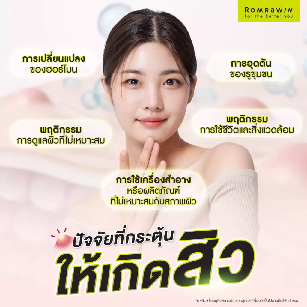 ปัจจัยที่กระตุ้นให้เกิด “สิว”