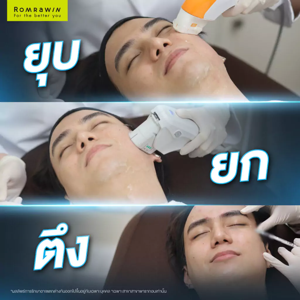 Ultra 4D LIFT- โปรแกรมหน้ายุง ยกกระชับ เก็บกรอบ เพิ่มมิติให้ใบหน้า 