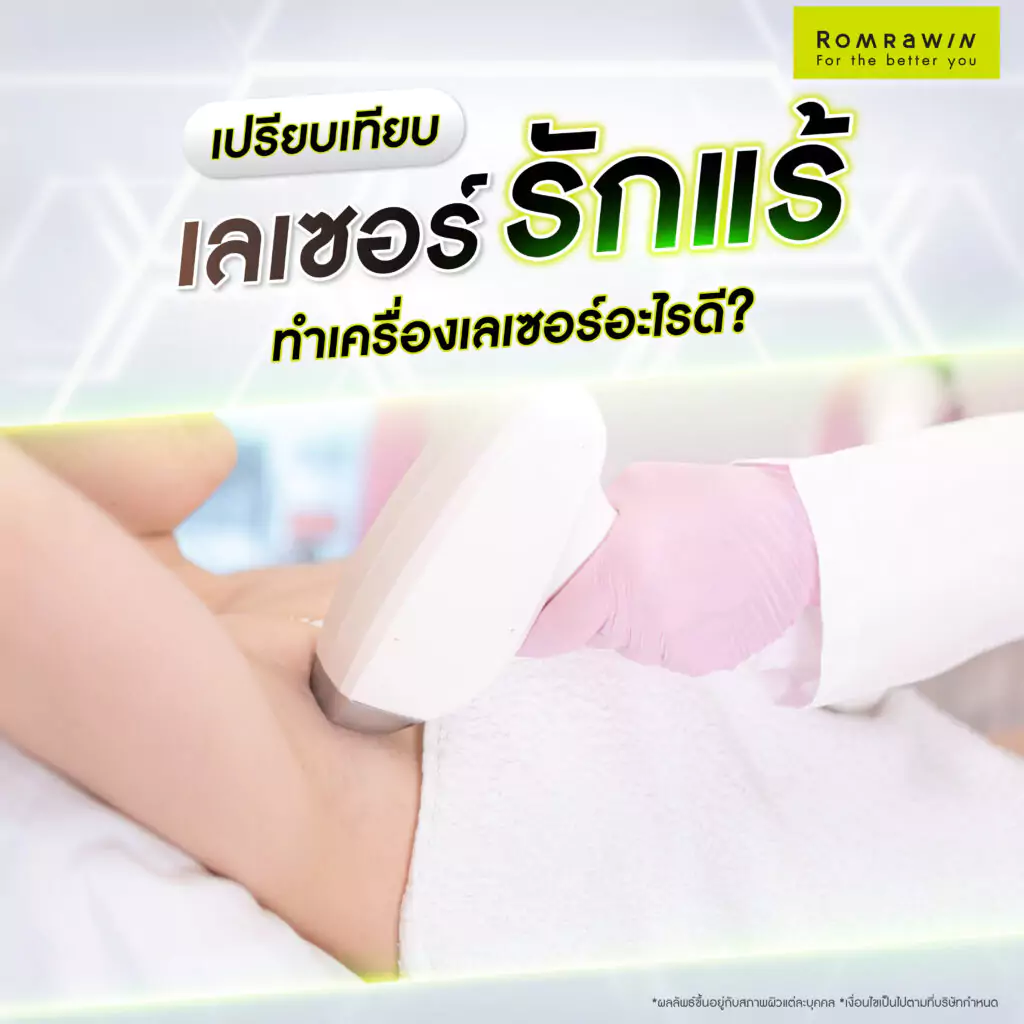 เปรียบเทียบเลเซอร์รักแร้ ทำเครื่องเลเซอร์อะไรดี ?