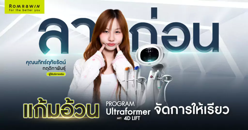 แก้มอ้วน
