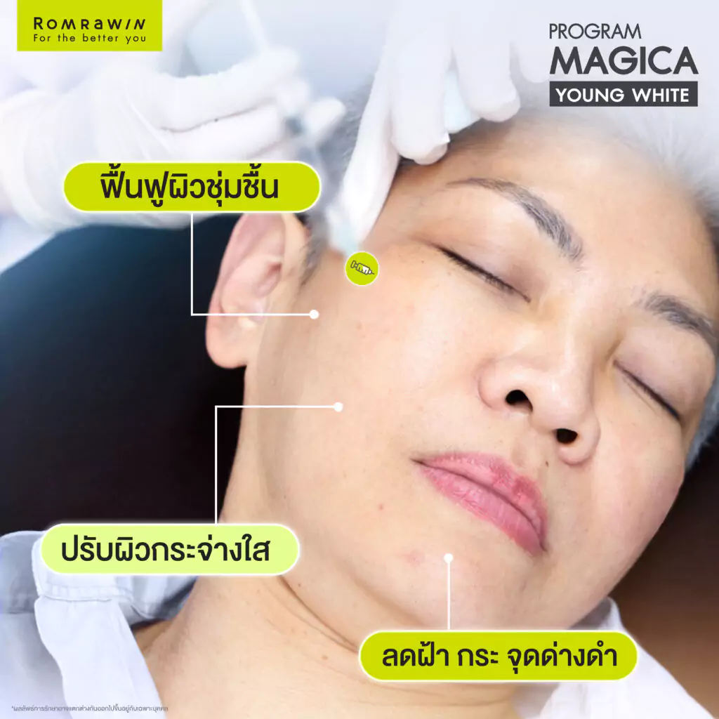 MAGICA YOUNG WHITE คุณฝน สิรินธร
