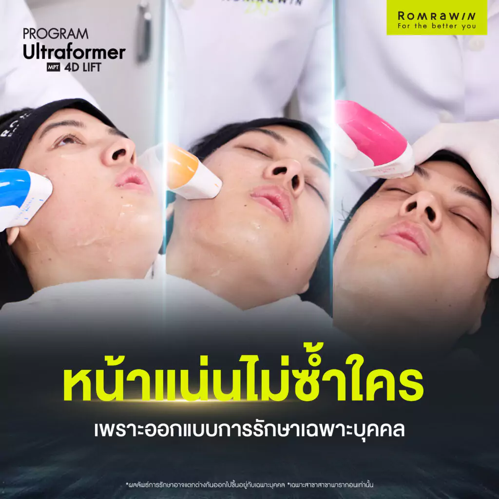 คุณตังโก้ Ultraformer MPT 4D LIFT กรอบหน้าชัดแบบผู้ชายสมัยใหม่ 