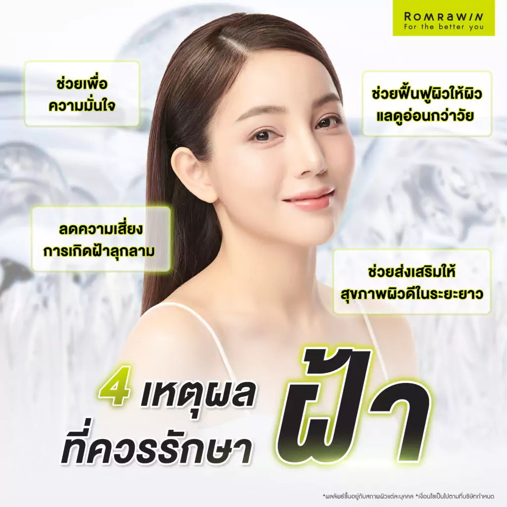 4 เหตุผลที่ควรรักษาฝ้า