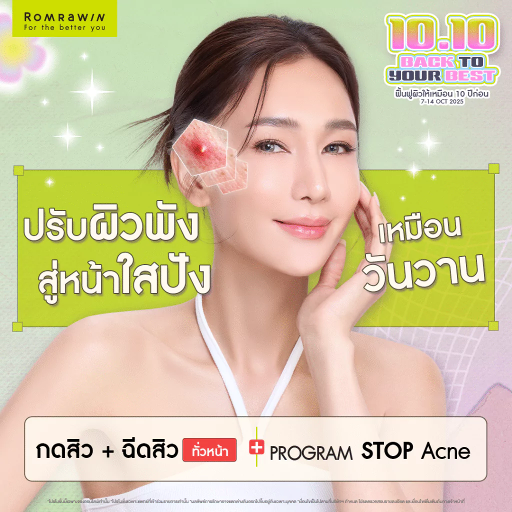 10.10 Back to Your Best ปรับผิวพัง สู่หน้าใสปังเหมือนวันวาน