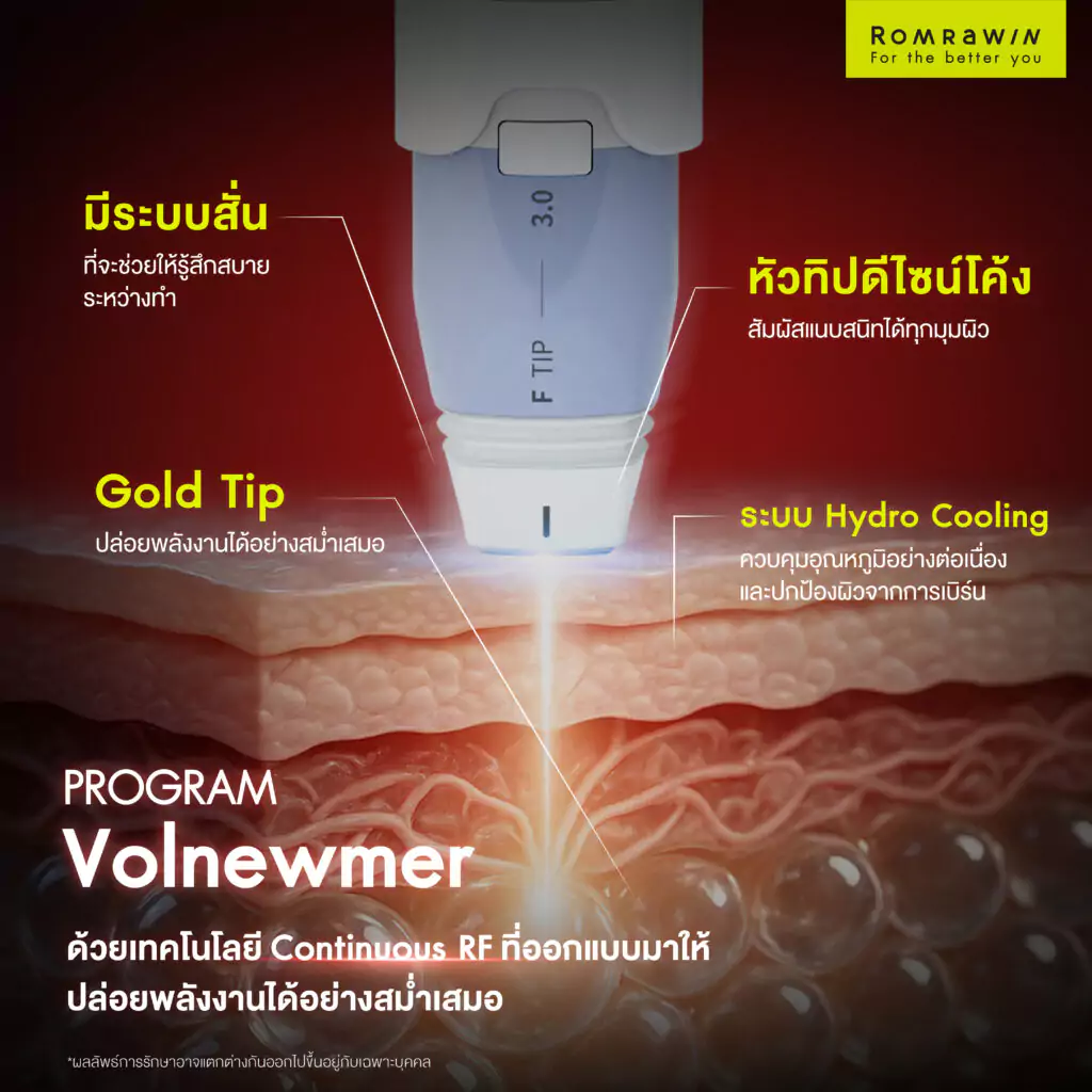 ความพิเศษของ VOLNEWMER