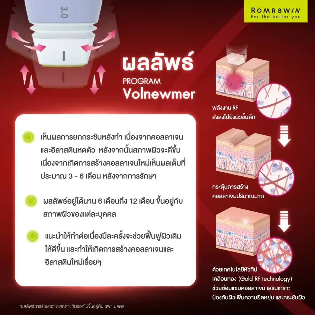 ผลลัพธ์ของการทำ Volnewmer