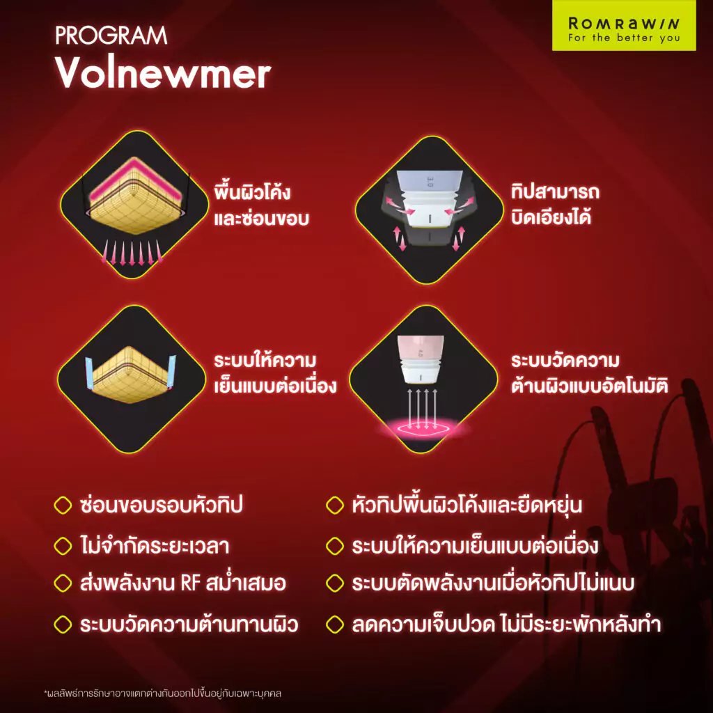 Advanced Technology: Gold RF Technology