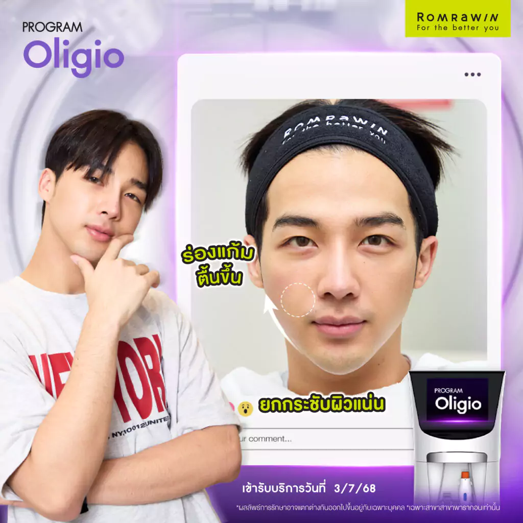Oligio คุณกัสหน้าชัด แก้มยุบ ถ่ายบัตรประชาชนสุดเป๊ะ จนเป็นไวรัล