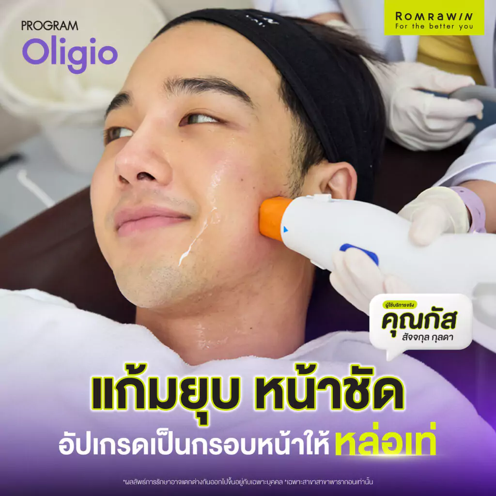 Oligio คุณกัสหน้าชัด แก้มยุบ ถ่ายบัตรประชาชนสุดเป๊ะ จนเป็นไวรัล