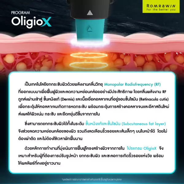 OligioX