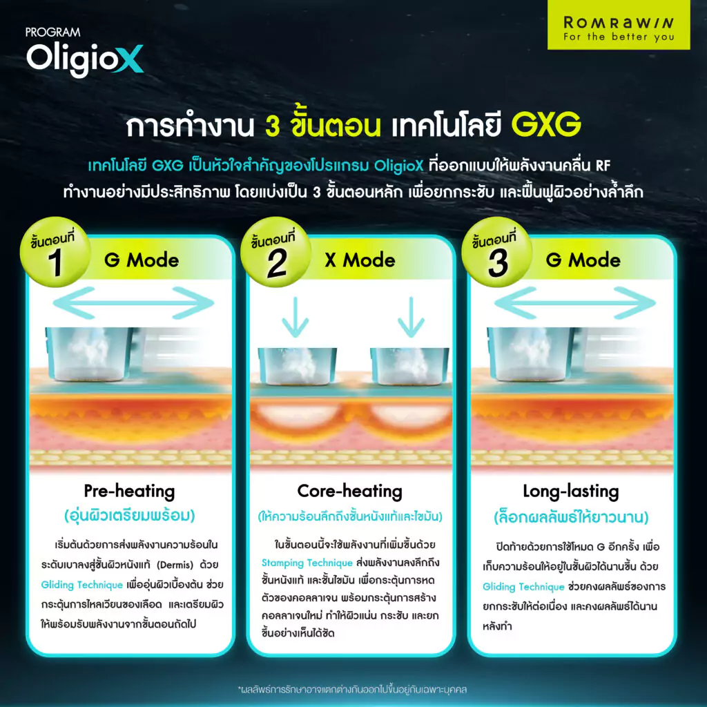 การทำงานเทคโนโลยี GXG