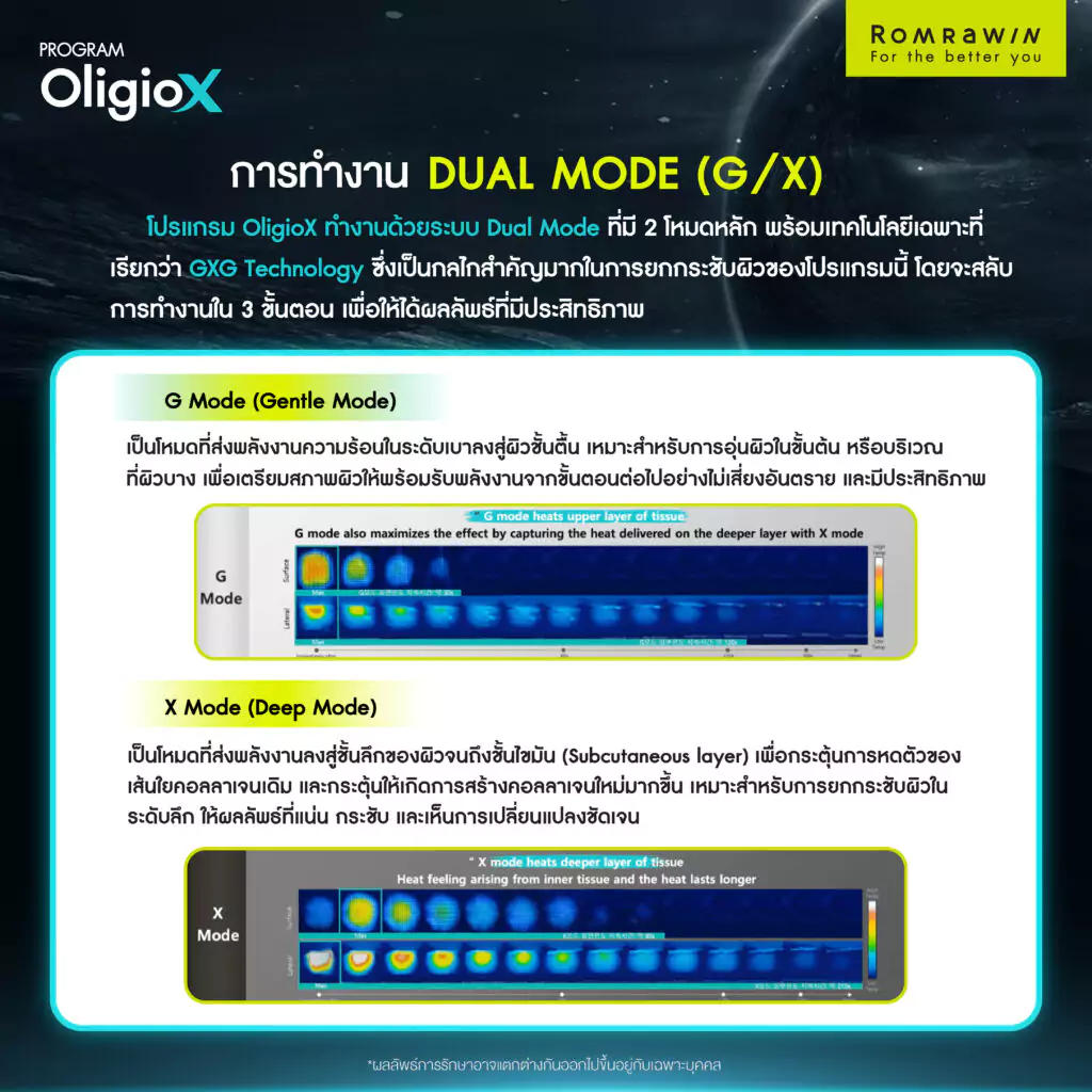 Dual Mode (G / X Mode)