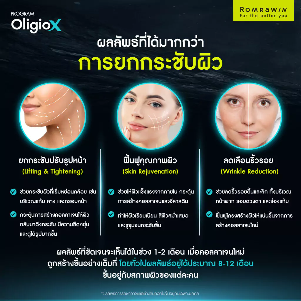 ผลลัพธ์ในการรักษาด้วย Oligio X