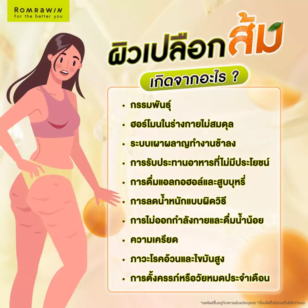 ผิวเปลือกส้ม หรือเซลลูไลท์ เกิดจากอะไร?