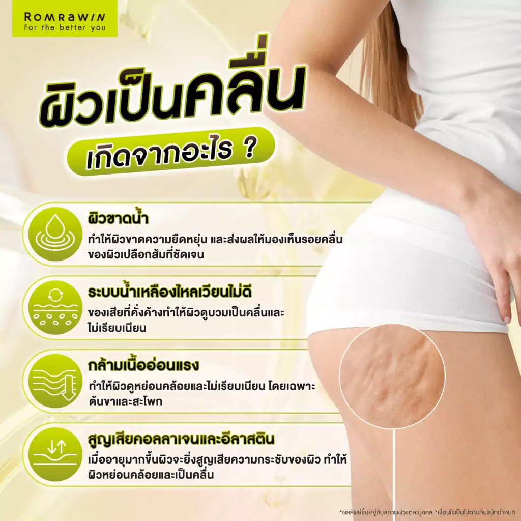 ผิวเป็นคลื่น ๆ เกิดจากอะไร?